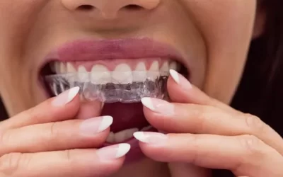 Invisalign Nashville: Clear Aligner Therapy for Discreet Orthodontic Correction